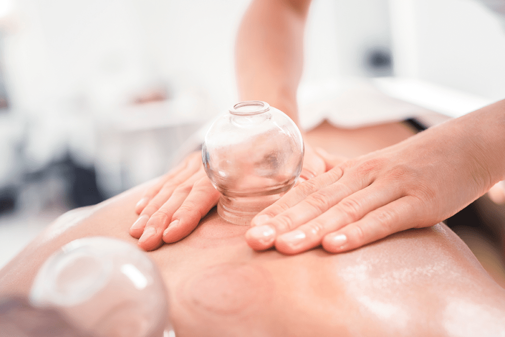 cupping_therapy_treatment